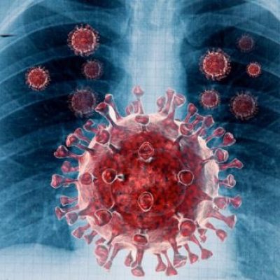 Coinfección de Tuberculosis y COVID-19: Impacto, Diagnóstico y Cuidados por Edades